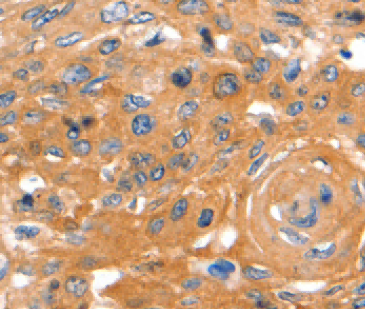 CAP2 Polyclonal Antibody - 3