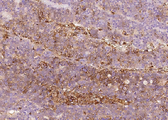 Beta-2 microglobulin/B2M Monoclonal Antibody - small - 3