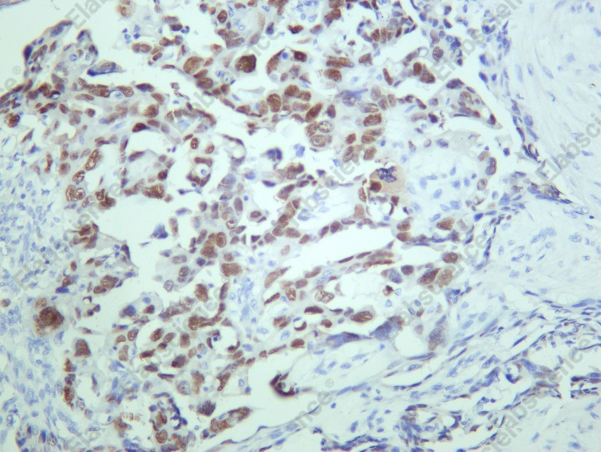 Recombinant p53 Monoclonal Antibody - 5