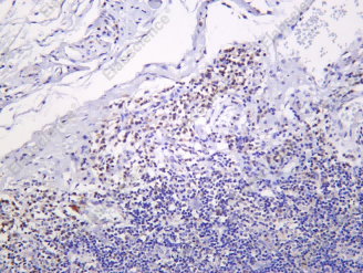 Recombinant Blimp-1 Monoclonal Antibody - 1