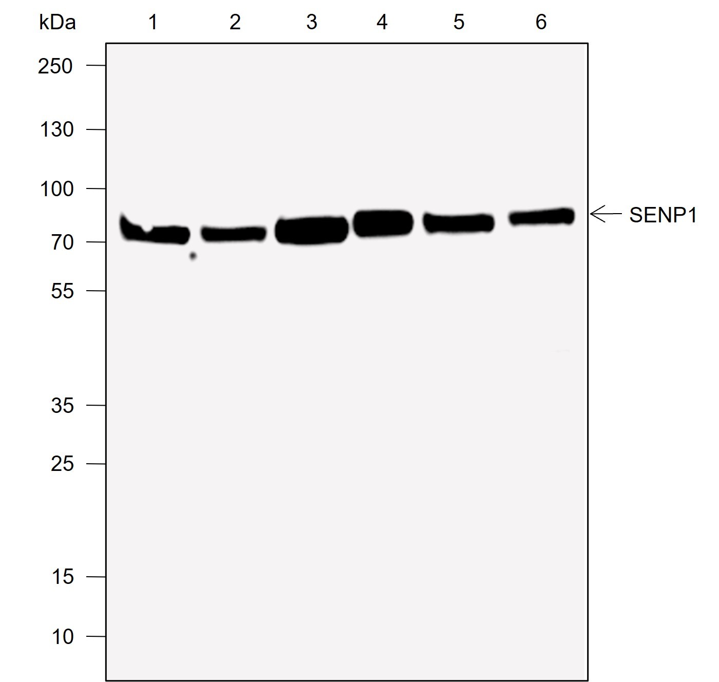 Recombinant SENP1 Monoclonal Antibody-searchlist-1