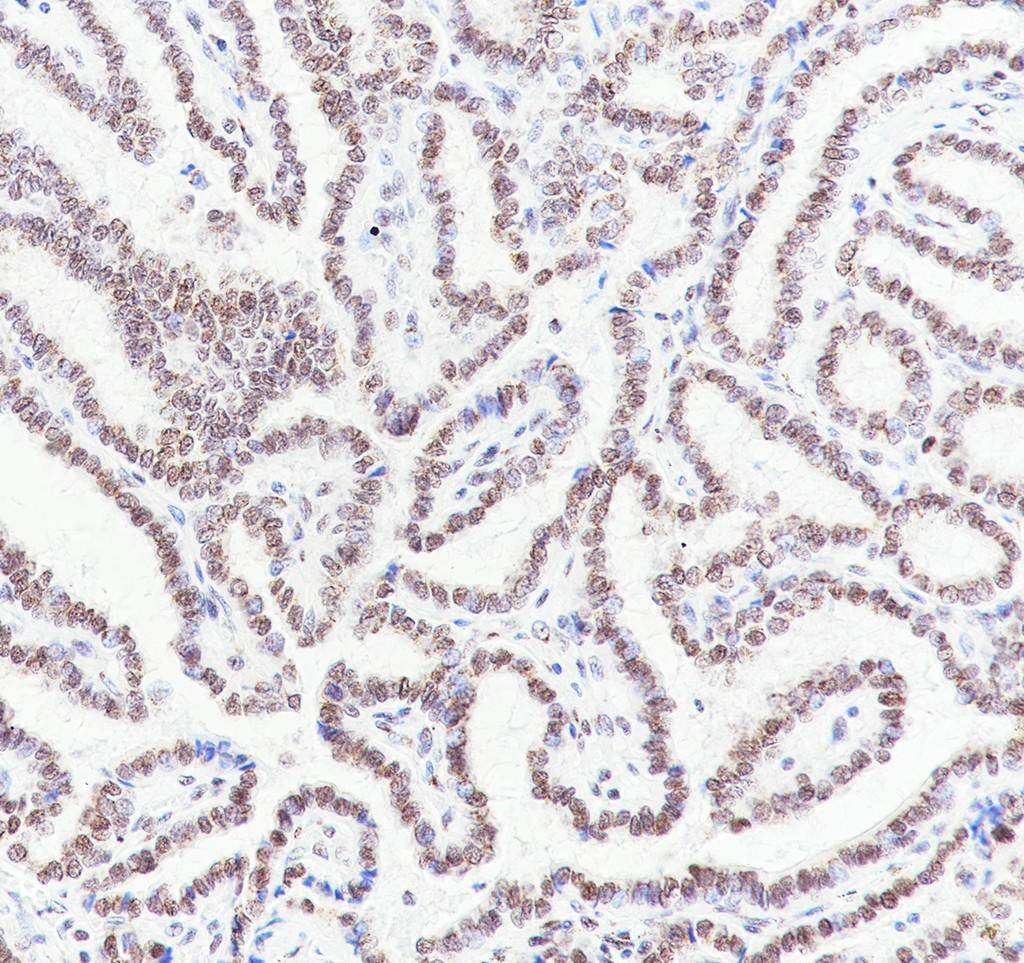 Recombinant PNKP Monoclonal Antibody - small - 4