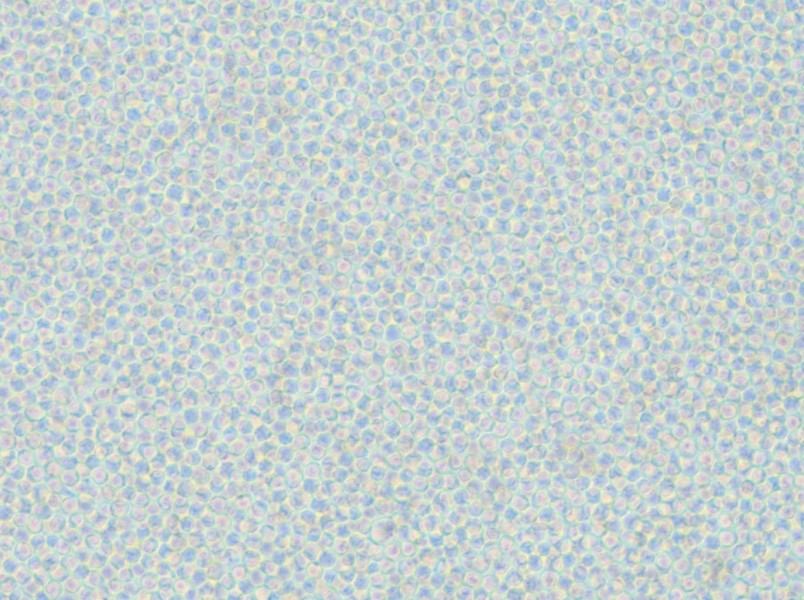 OCI-AML-2 Cell Complete Medium - small - 5