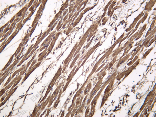 Recombinant Myoglobin Monoclonal Antibody - 1