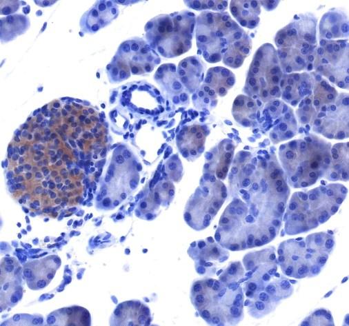 Recombinant IRAK1 Monoclonal Antibody-searchlist-2