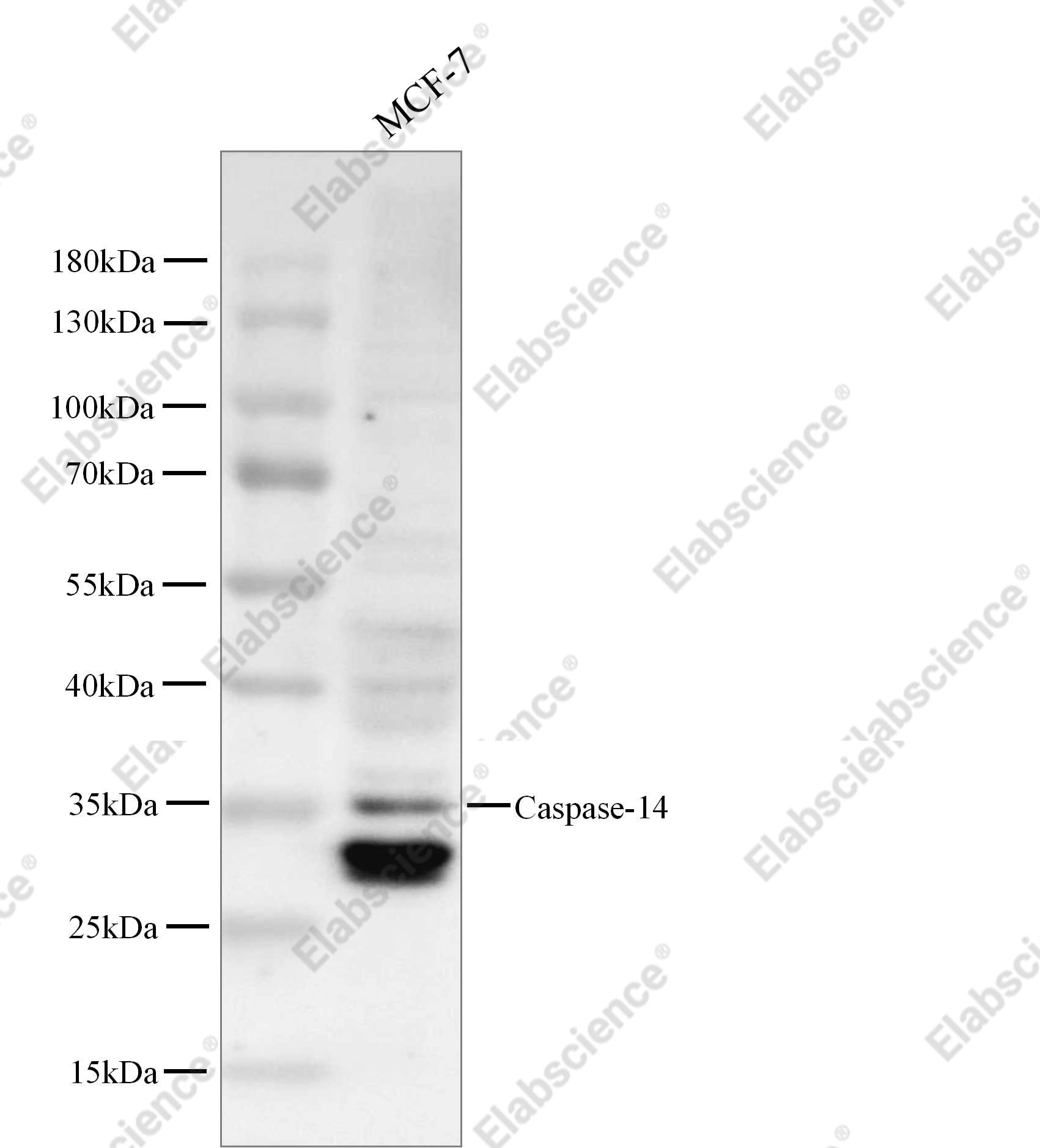 Recombinant Caspase-14/CASP14 Monoclonal Antibody - 2