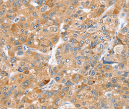 ZFP36L2 Polyclonal Antibody - 2