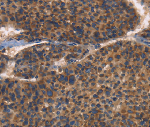 CD61 Polyclonal Antibody - 2
