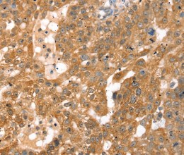 RPS6KA1 Polyclonal Antibody - 2