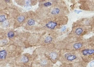 Recombinant Tissue Plasminogen Activator Monoclonal Antibody-searchlist-3
