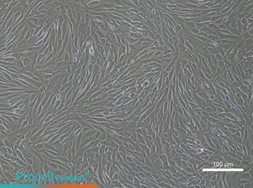 Human Mammary Cancer Fibroblast Complete Medium - 3