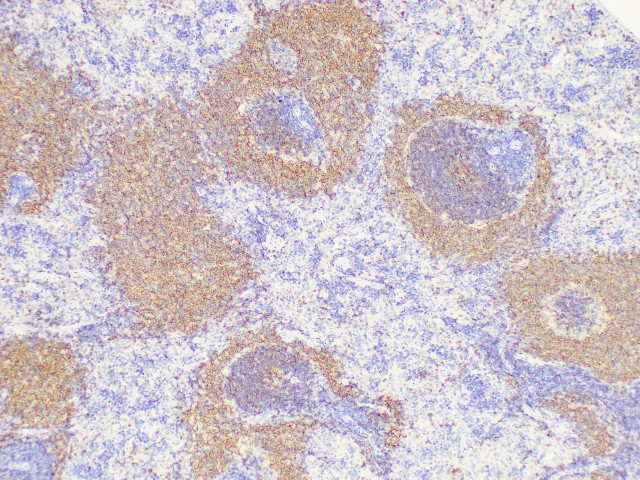 Purified Anti-Mouse CD106 Antibody[M/K-2.7]-产品推荐-1