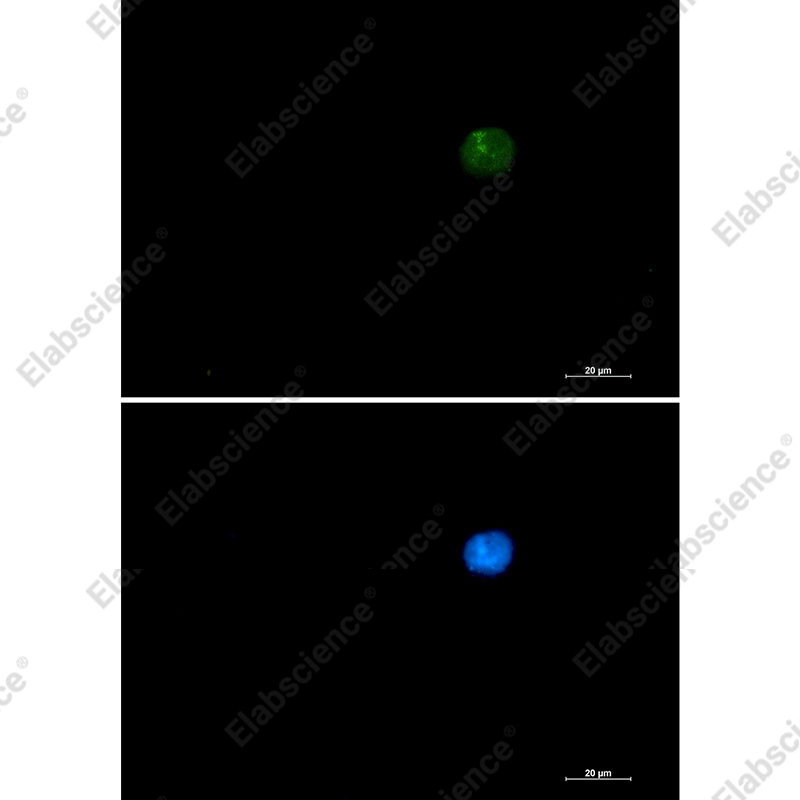 Recombinant SMARCA2 Monoclonal Antibody - 2
