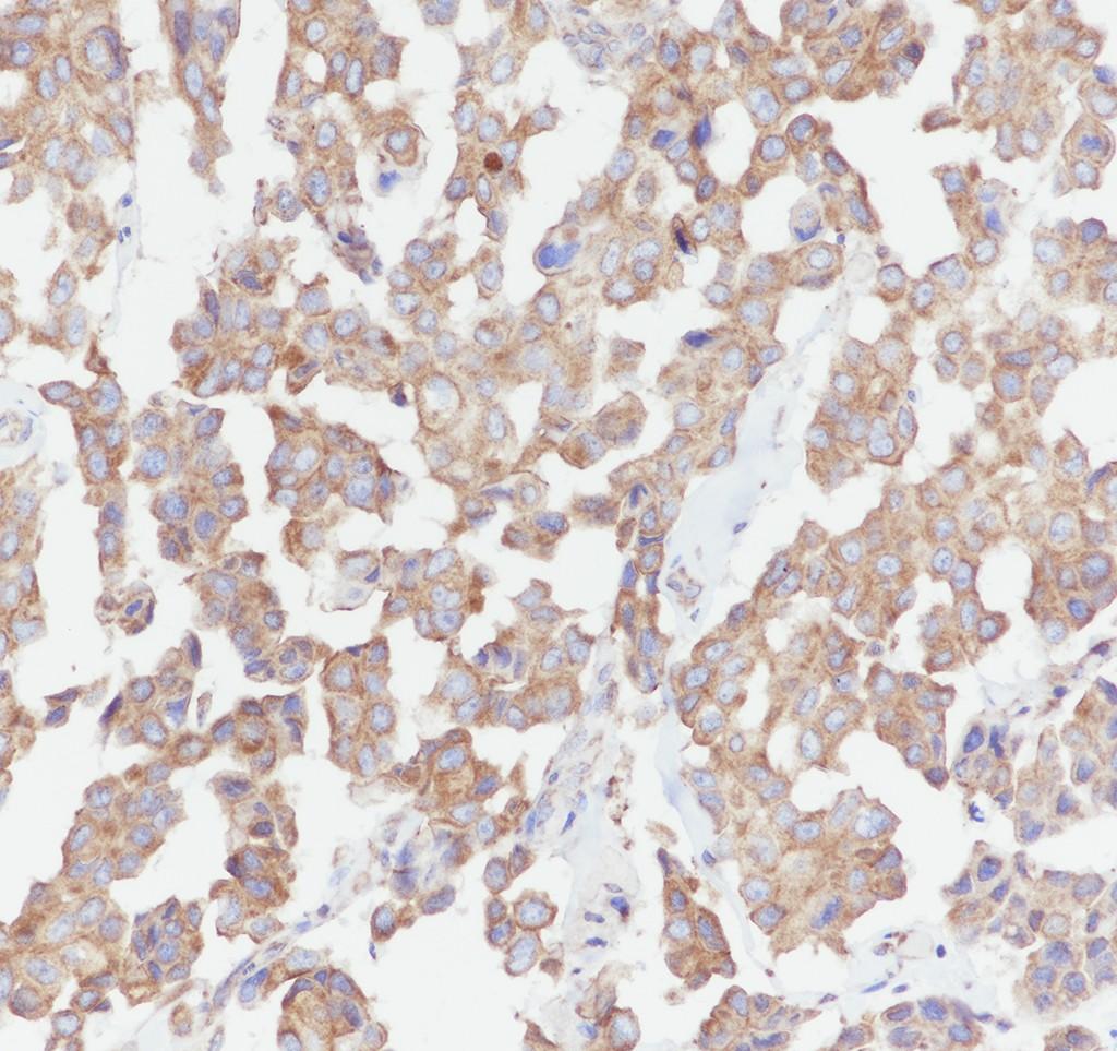 Recombinant eIF4A2 Monoclonal Antibody - small - 4