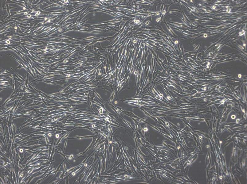 MeWo Cell Complete MediumMeWo Cell Complete Medium - 2