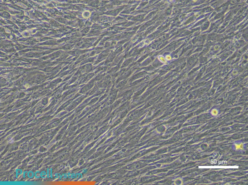 Human Adipose-derived Mesenchymal Stem (Primary cell immortalization) Cell Complete Medium - 4