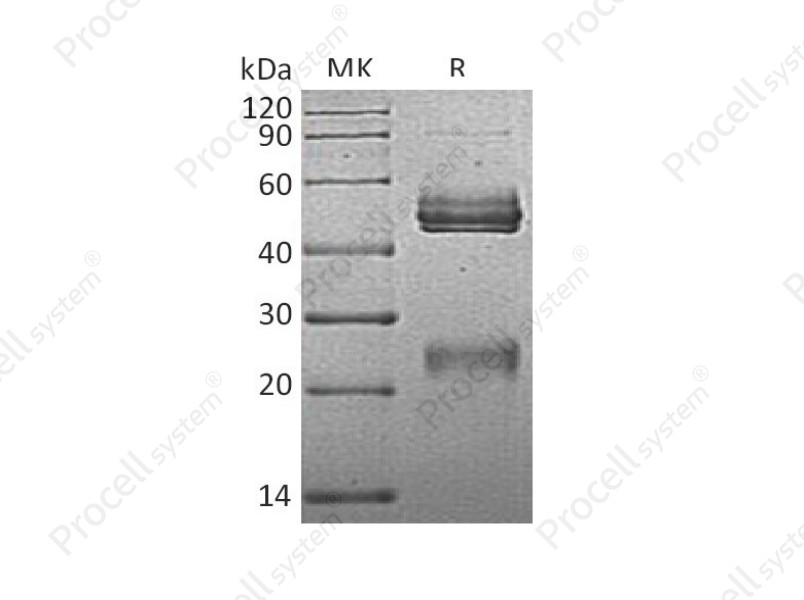 IL-12 p40/IL-12B/CLMF p40, Mouse, Recombinant