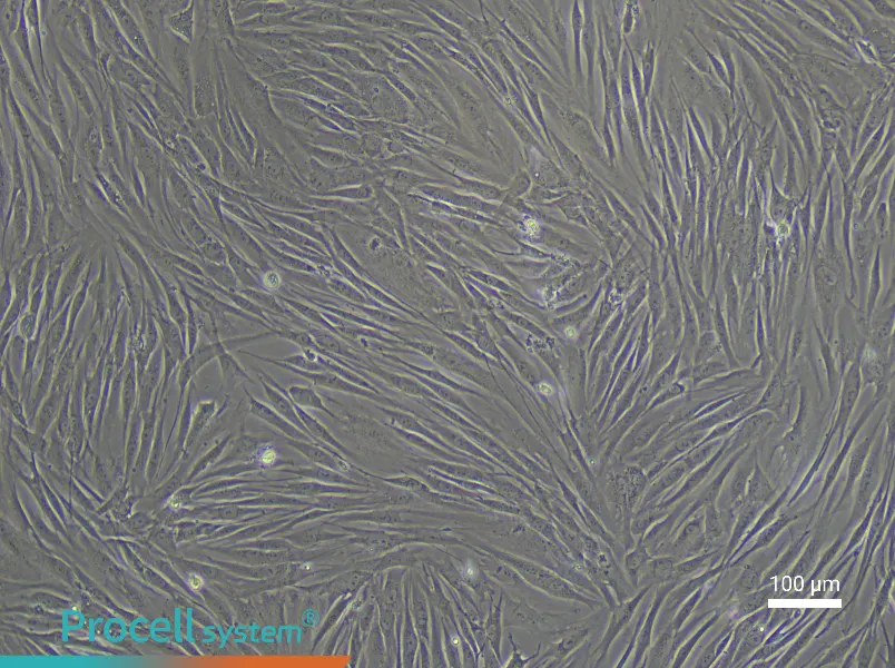 Human Esophageal Smooth Muscle Cell Complete Medium - 1