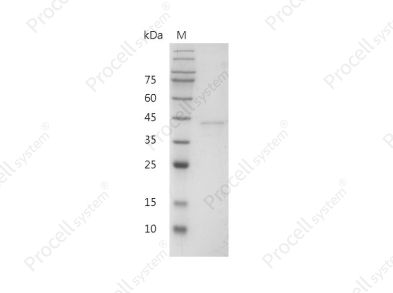 IL-12 p40/IL-12B/CLMF p40, Mouse, Recombinant