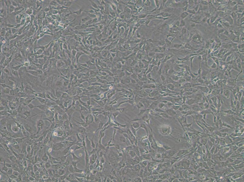 Tb 1 Lu Cell Complete Medium - 2