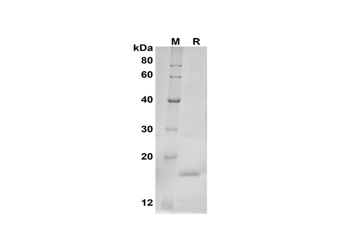 Recombinant Mouse FGF21 Protein(Trx Tag)-产品推荐-1