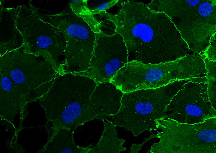 Recombinant VE-Cadherin/CD144/CDH5 Monoclonal Antibody - small - 2