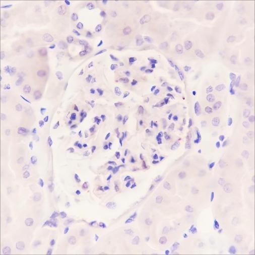 Recombinant CGA/hCG alpha Monoclonal Antibody - 3