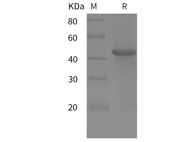 Recombinant Human CDH1 Protein(Trx Tag)-产品推荐-1