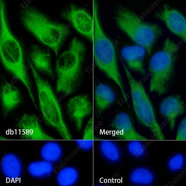 Recombinant Vimentin/VIM Monoclonal Antibody - 5