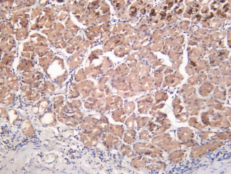 Recombinant pS2 Monoclonal Antibody - 1