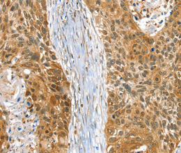 RAB27A Polyclonal Antibody - 3