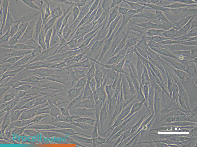 Human Mammary Cancer Fibroblast Complete Medium - small - 4