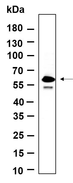 Recombinant Phospho-SMAD5 (Ser463, Ser465) Monoclonal Antibody - 1