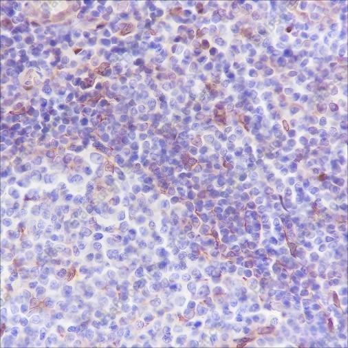 Recombinant VISTA Monoclonal Antibody - 2
