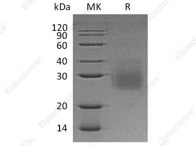 Recombinant Human HVEM/TNFRSF14 Protein (His Tag) - 1