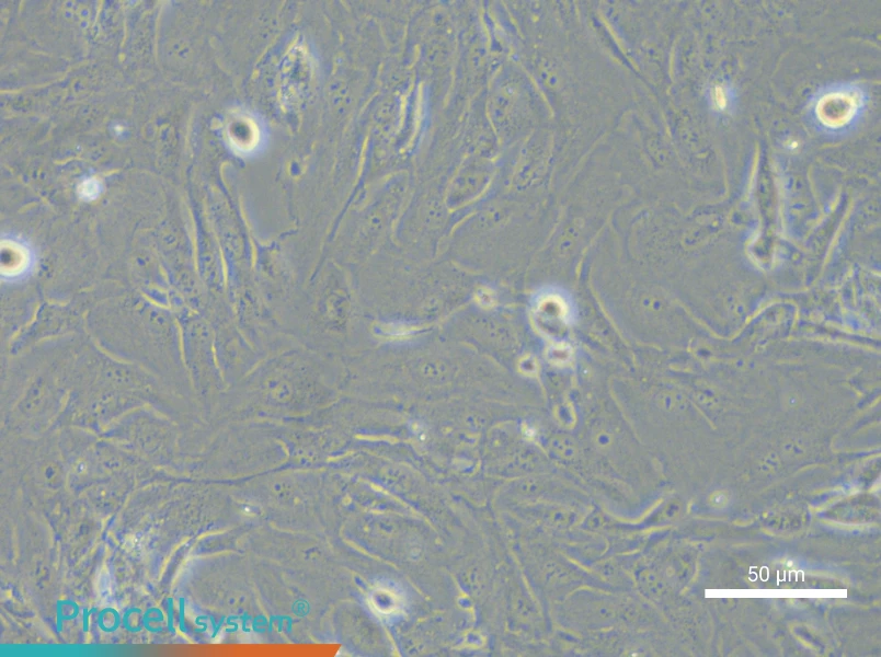 SNU-423 Cell Complete Medium - 6