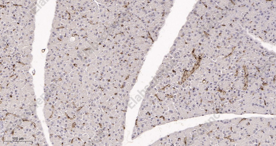 Recombinant FABP4 Monoclonal Antibody - 3
