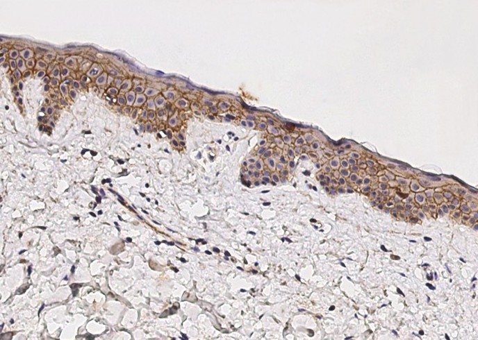 Recombinant beta-Catenin/CTNNB1 Monoclonal Antibody - small - 2