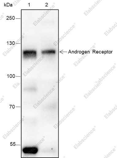 Recombinant Androgen Receptor (CT) Monoclonal Antibody - 1