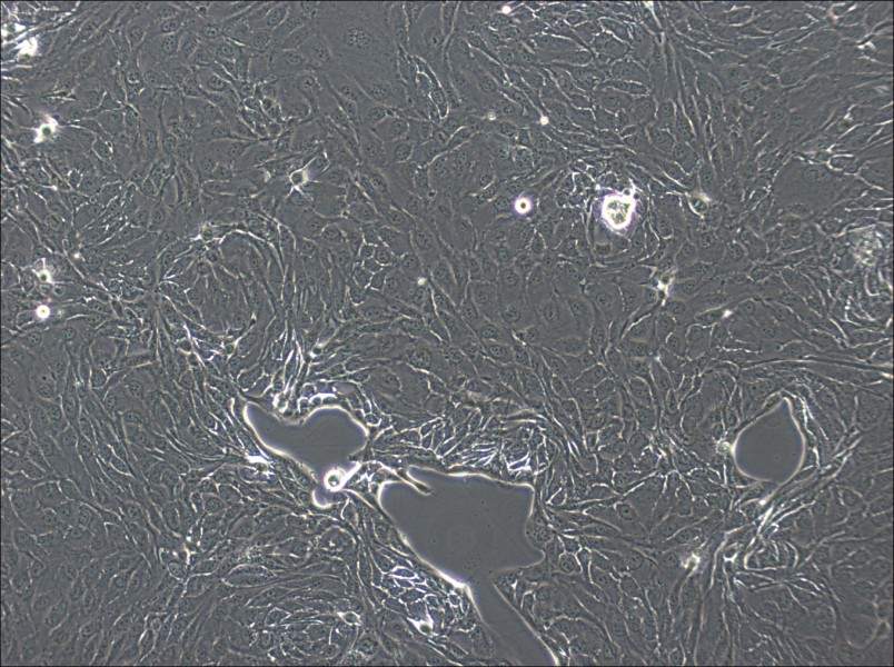 NCI-H2444 Cell Complete Medium - 2