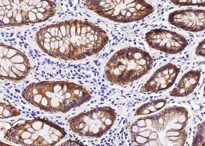 Recombinant GPA33 Monoclonal Antibody - small - 2