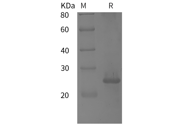 Recombinant Mouse IL-10 Protein(His Tag)-产品推荐-1