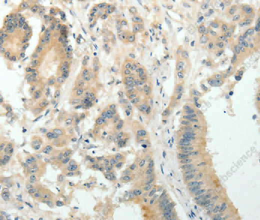 SIRT3 Polyclonal Antibody - 2