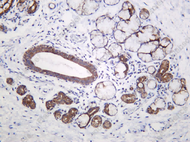 Recombinant NCoA 3 Monoclonal Antibody - 1