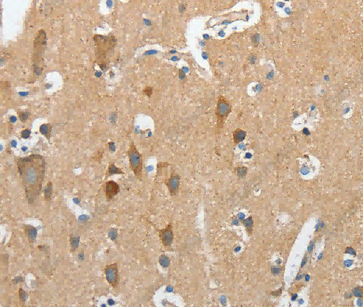 DSCR1 Polyclonal Antibody - 3