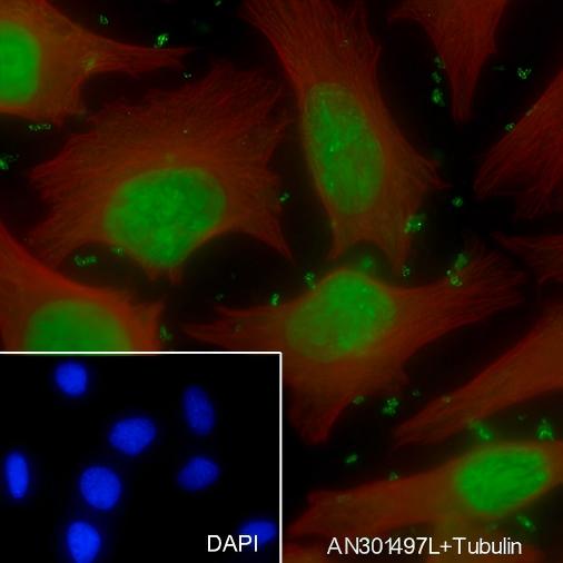 Recombinant COPS3 Monoclonal Antibody - small - 5