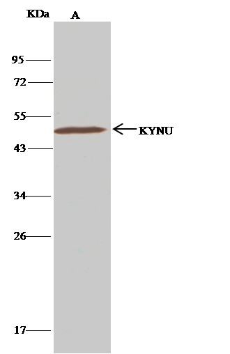 Recombinant KYNU Monoclonal Antibody - small - 2