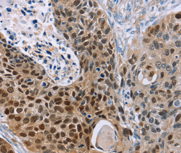 MAGEA10 Polyclonal Antibody - 2