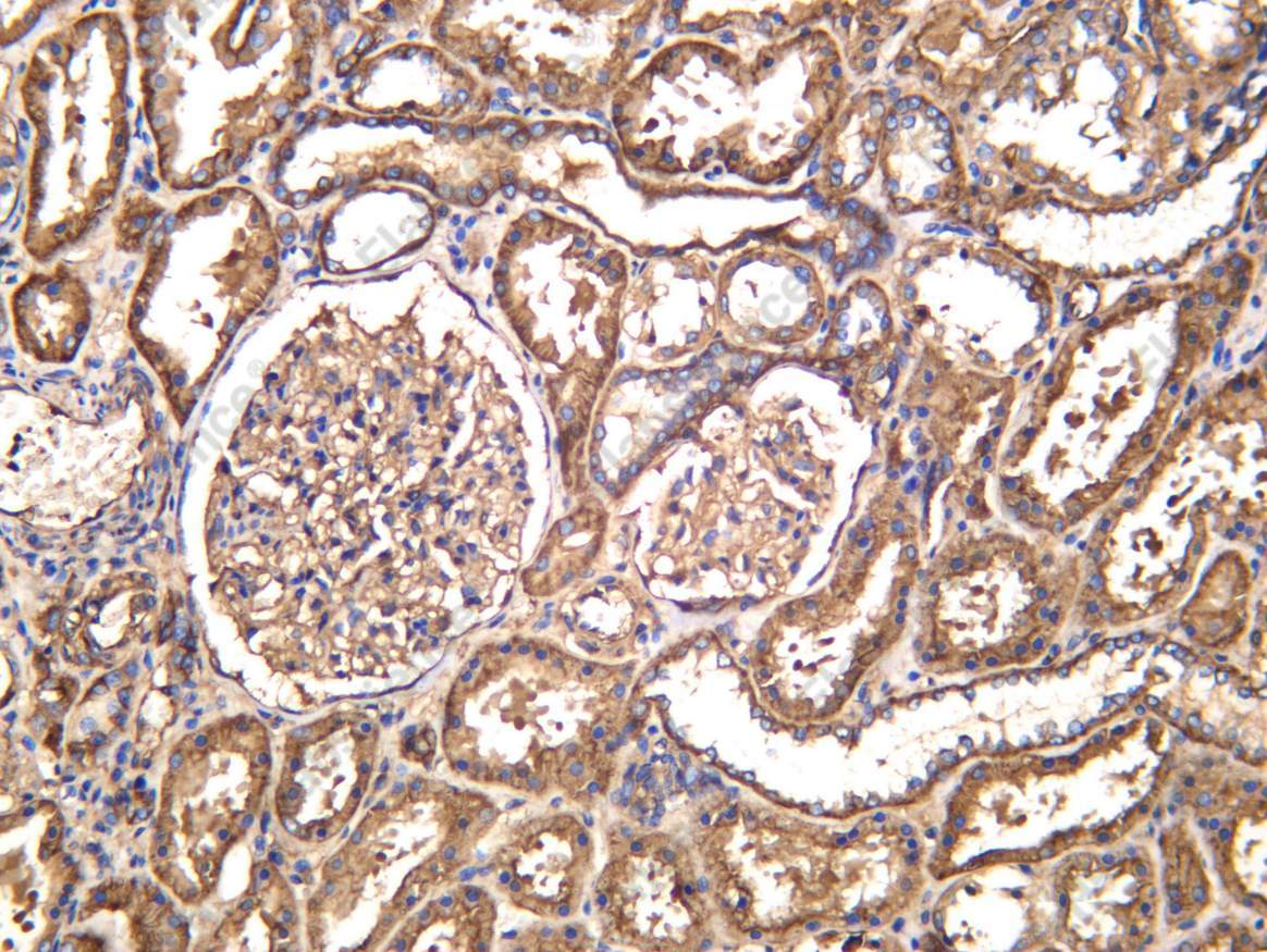 Recombinant CD46 Monoclonal Antibody - 1