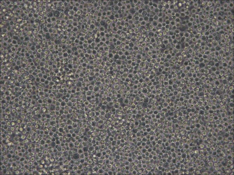 MOLM-13 Cell Complete Medium - small - 5